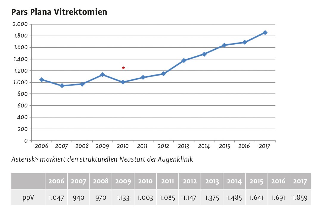 Entwicklung der Zahl an Pars-Piana-Vitrektomien