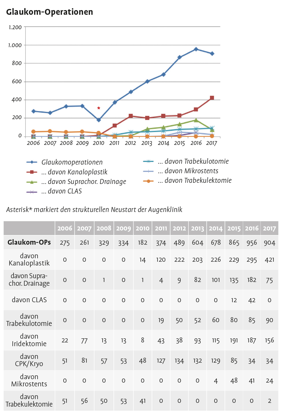 Entwicklung der Zahl an Glaukom-Operationen