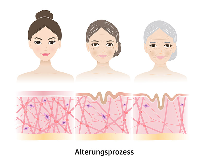 Alterungsprozess Augenklinik Sulzbach