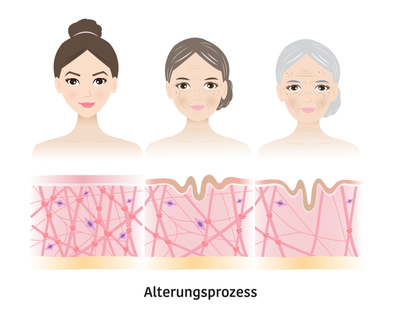 illustration haut alterungsprozess augenklinik sulzbach