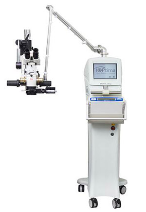 CO2-Laser-assistierte tiefe Sklerektomie