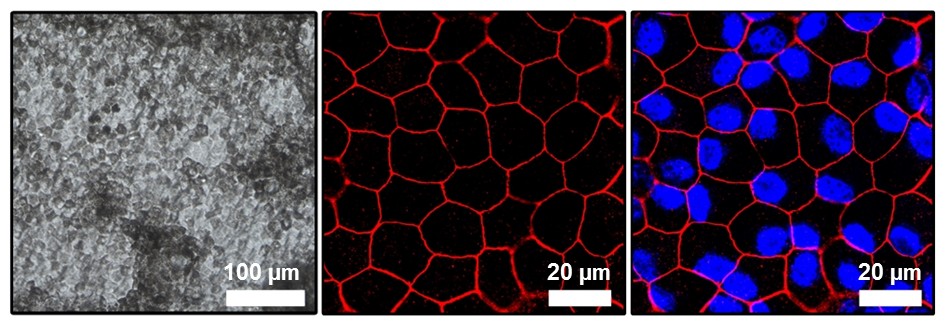 Durchlicht-und Immunfluoreszenzaufnahmen in-vitro kultivierten Zellschicht humaner retinaler Pigmentepithelzellen - Tissue Engineering Sulzbach Augenklinik Saarland