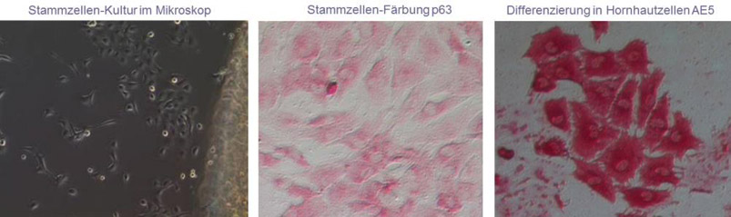 Limbusstammzellkultur