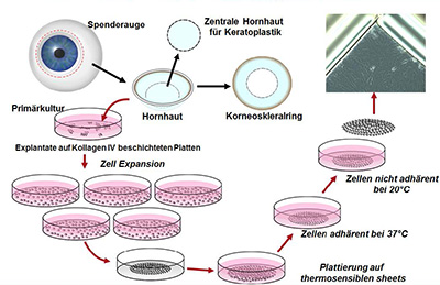 Stammzellgewinnung